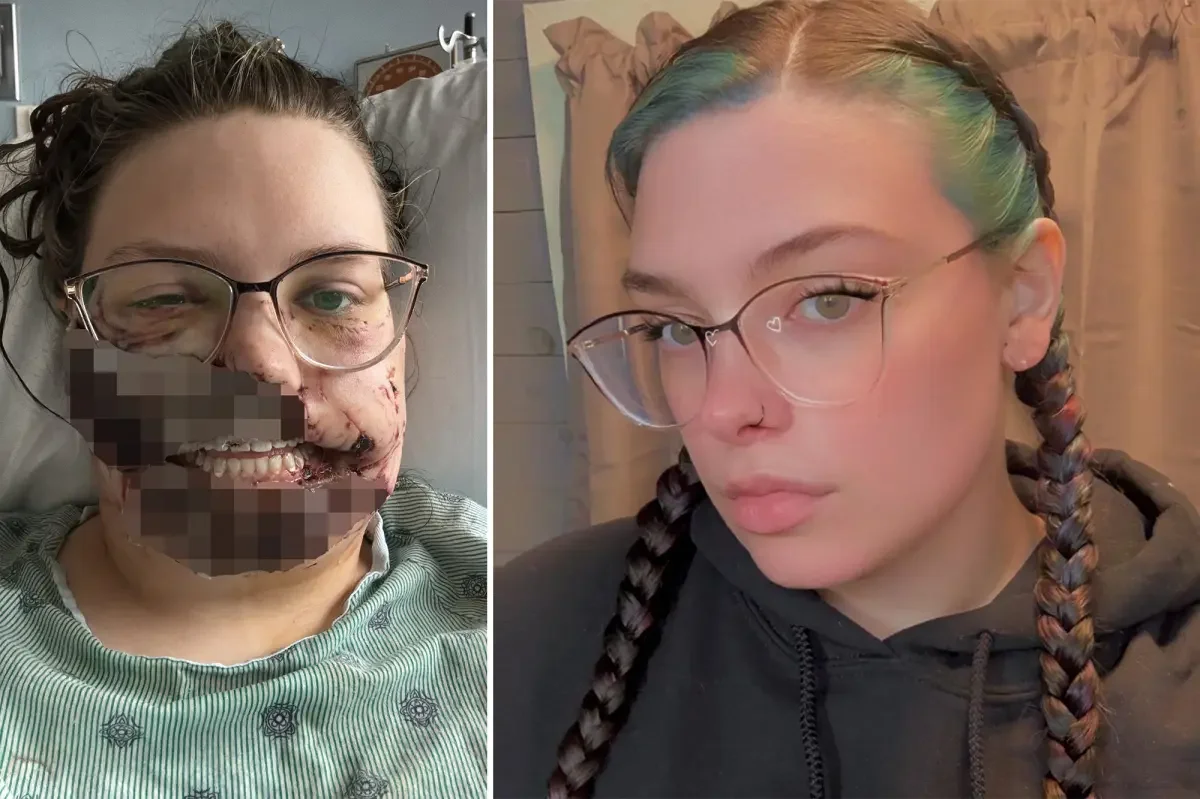 Illinois Mother Sustains Severe Facial Injuries After Seizure Triggers Rescue Dog Attack
